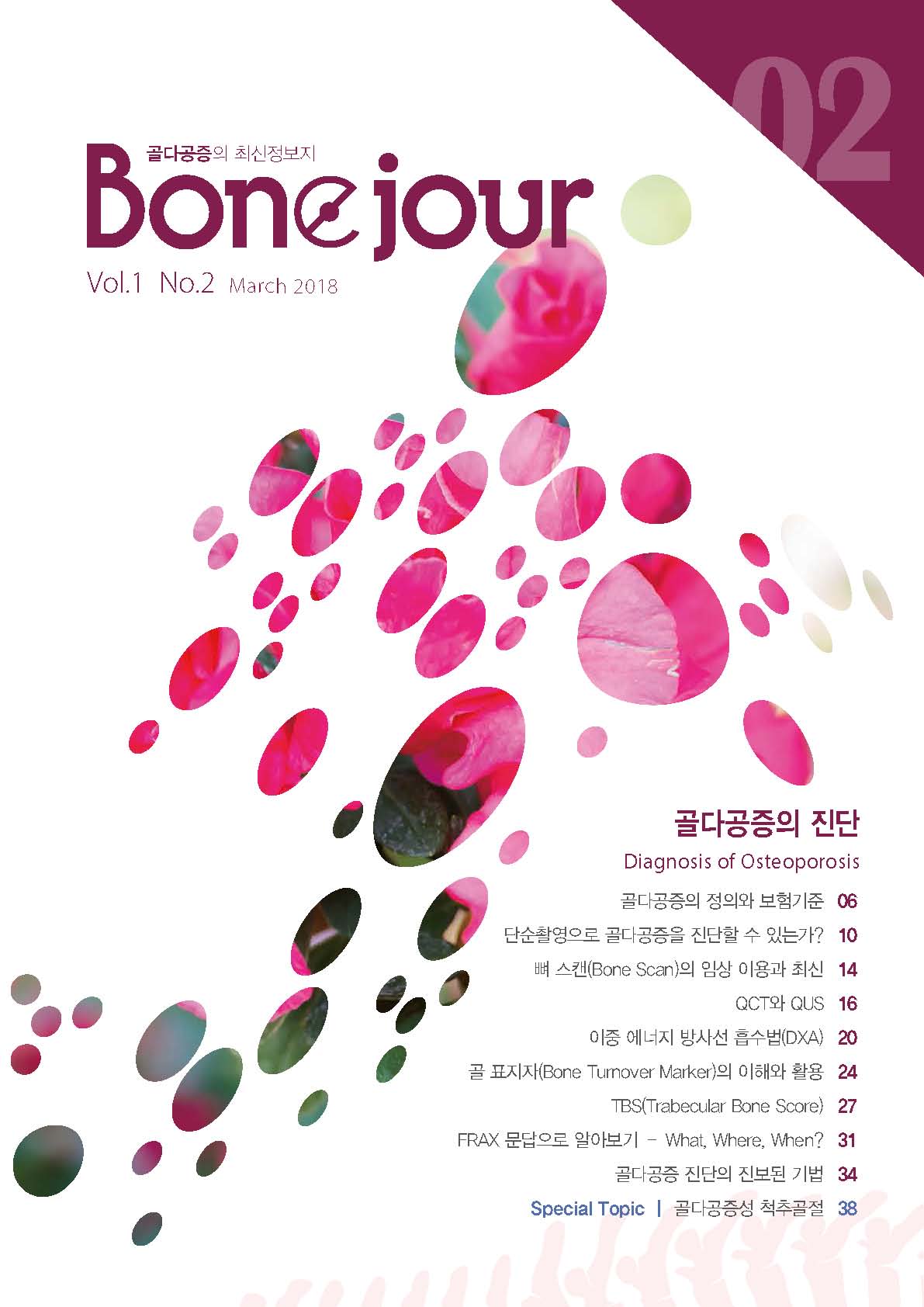 Bonejour 2호_골다공증의 진단