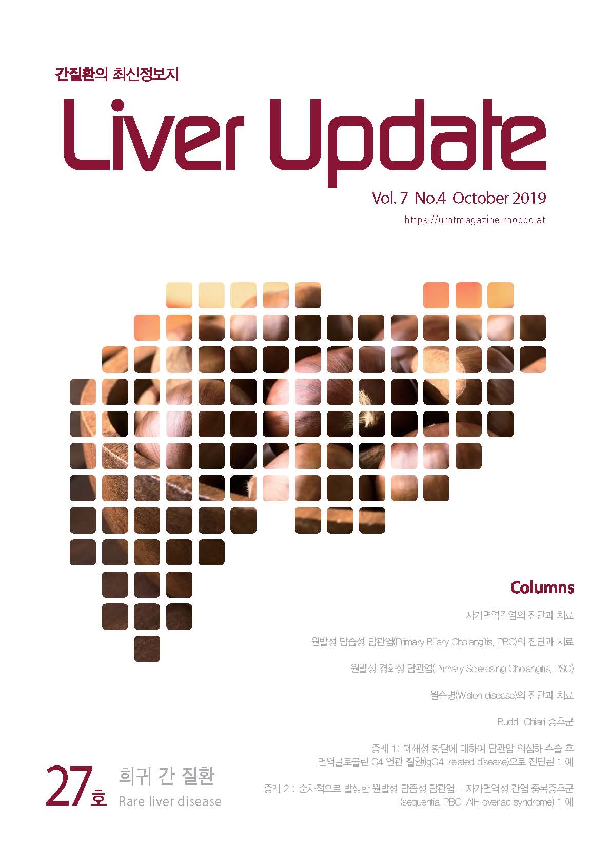 Liver Update 27호_희귀 간 질환