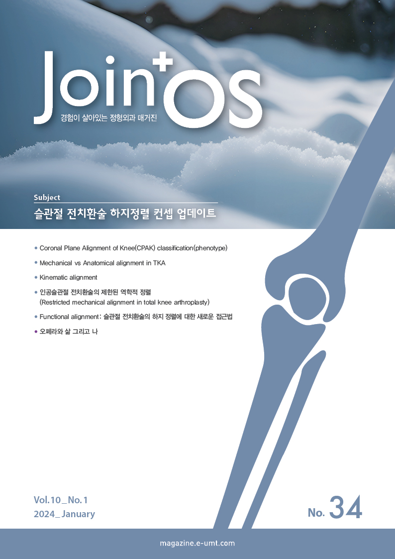 JoinOS 34호 – 슬관절 전치환술 하지정렬 컨셉 업데이트