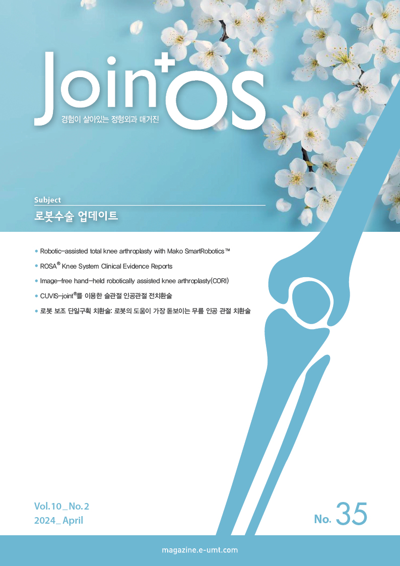 JoinOS 35호 – 로봇수술 업데이트